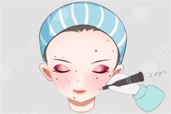 无忌取痣