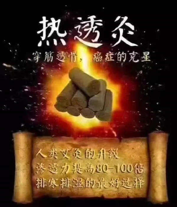 王氏热透灸 王氏热透灸
